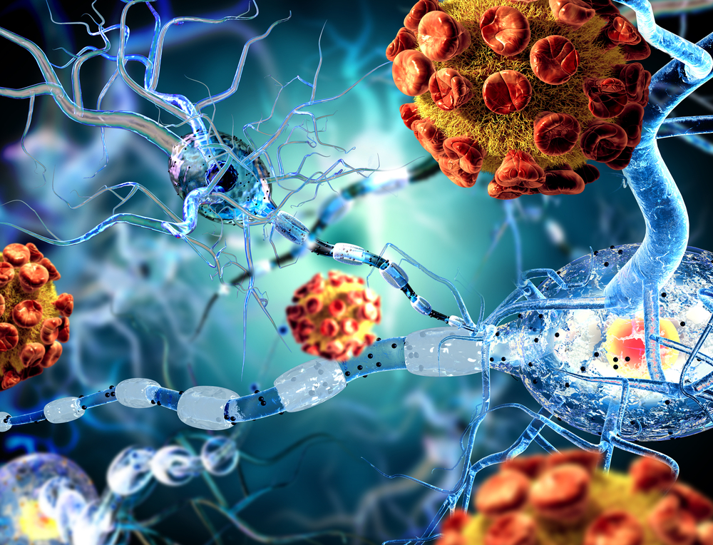 brain-cancer-causes-symptoms-and-treatment-options